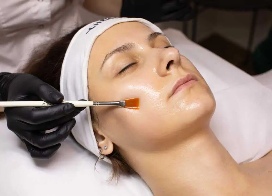 Chemical Peels Treatment by Elle Aesthetics In Mapleton Utah