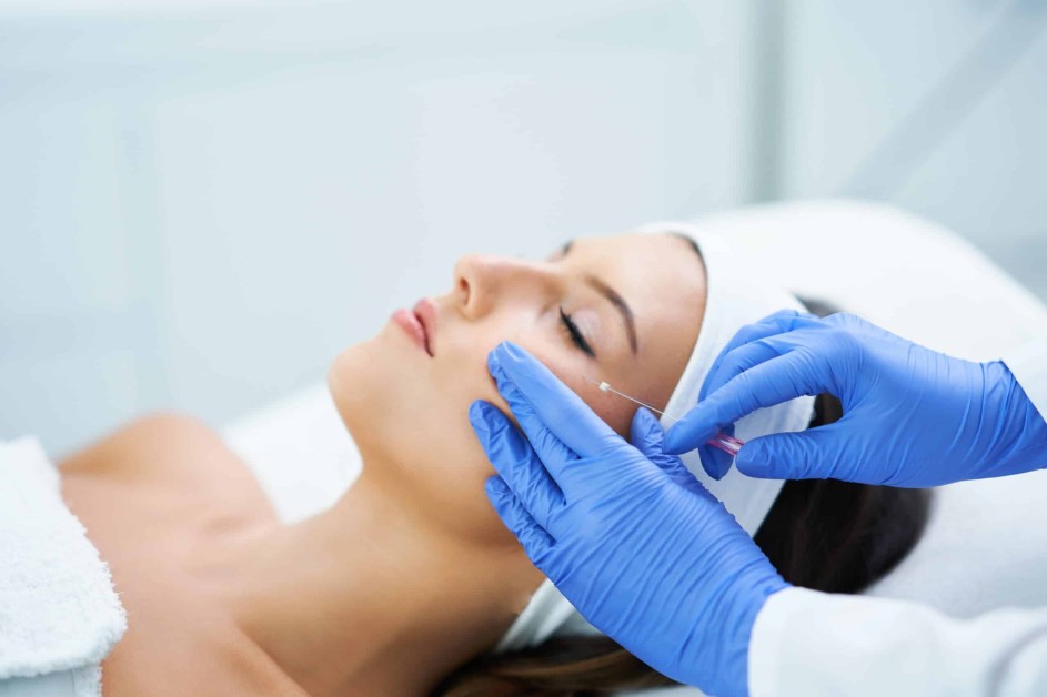 How Can the PDO Thread Lift Improve my Skin? 10 How Can the PDO Thread Lift Improve my Skin