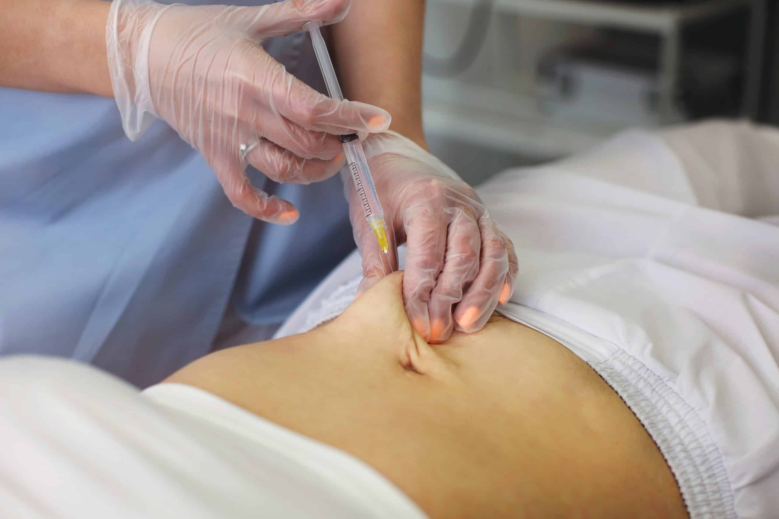 What is Lipodissolve Treatment How Does Lipodissolve Work